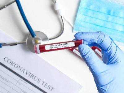 Armenia reports 1,385 new coronavirus cases, 24 deaths
