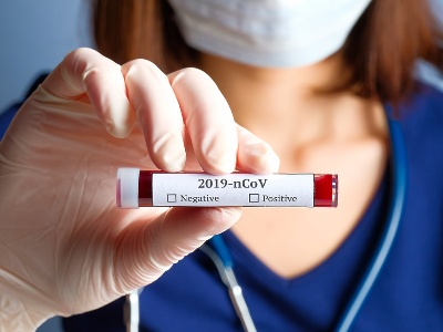 114 new cases of COVID-19 confirmed in Armenia