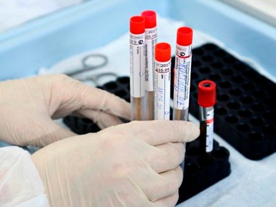 324 COVID-19 new cases reported in Armenia per day