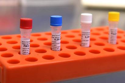 337 COVID-19 new cases in Armenia