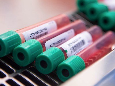 183 new cases of COVID-19 confirmed in Armenia
