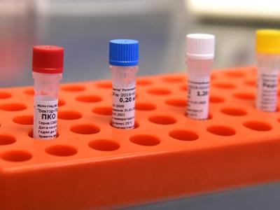196 new cases of COVID-19 confirmed in Armenia