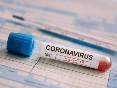 Four new cases of coronavirus reported in Karabakh