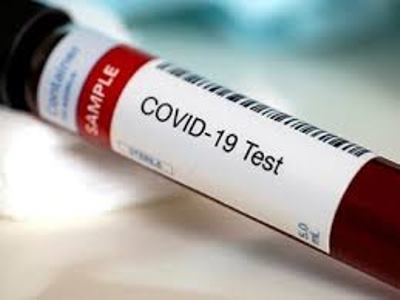 Armenia confirms 586 new coronavirus cases, 18 deaths