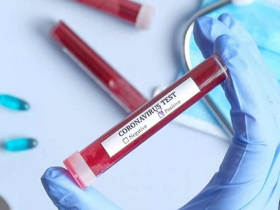 Seven new cases of coronavirus reported in Karabakh