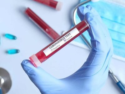 В Армении за сутки зарегистрировано 410 новых случаев заражения коронавирусом