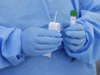 34 new cases of COVID-19 confirmed in Armenia