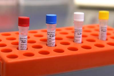 Armenia reports COVID-19 new 81 cases: 4 people die