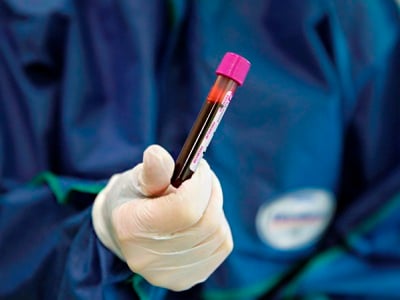 69 new cases of COVID-19 reported in Armenia