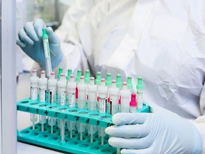 264 new cases of COVID-19 reported in Armenia per day