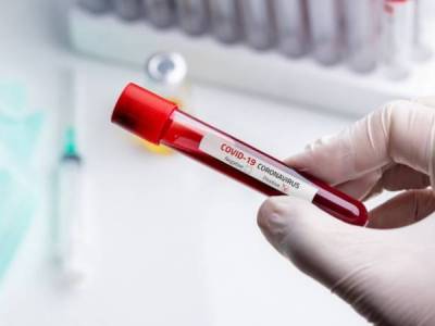 Karabakh reports 2 cases of coronavirus
