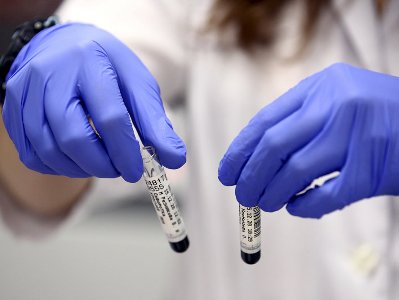 В Армении за сутки зарегистрировано 399 новых случаев заражения коронавирусом