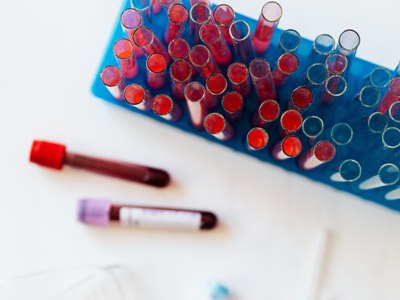507 new cases of COVID-19 confirmed in Armenia
