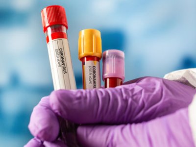 772 new cases of COVID-19 confirmed in Armenia