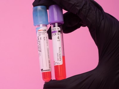 1,155 new cases of COVID-19 confirmed in Armenia