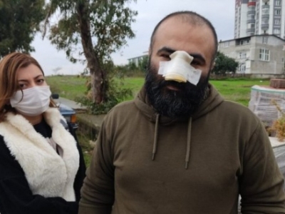 Pitbull bites Azerbaijani businessman's nose in Turkey