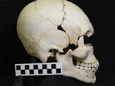 Археологи нашли в Карибском море 200-летний череп больного проказой