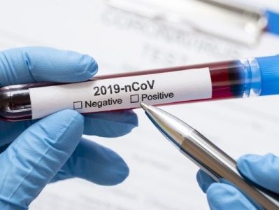 4 more die of coronavirus in Karabakh