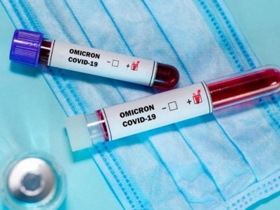 Armenia health ministry: Natural immunity does not protect against Omicron variant