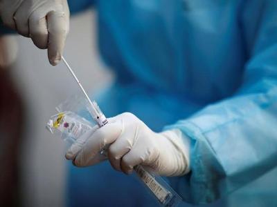 В Армении за сутки зарегистрировано 140 новых случаев заражения коронавирусом