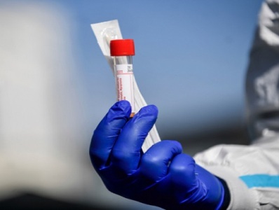 51 new cases of COVID-19 confirmed in Armenia