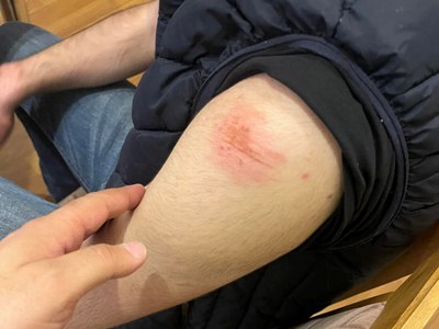 По факту попытки задержать несовершеннолетнего представлено заявление