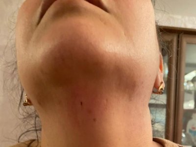 Journalist attacked in Baku