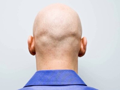 В Великобритании  оскорбление лысого мужчины на рабочем месте приравнивается к сексуальным домогательствам