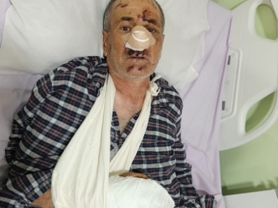 В Армении медведь напал на мужчину, собиравшего конский фенхель