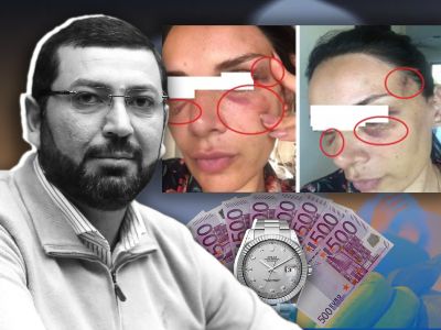 Politik.am: Armenia ruling force MP constantly beat wife in whose house he lived