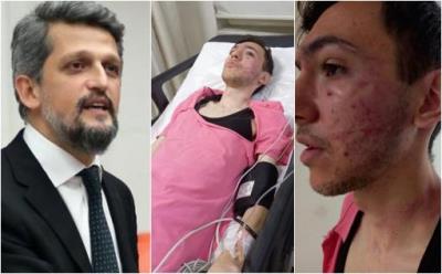 Garo Paylan: Armenian youth beaten in Turkey on racist grounds