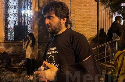 Глава ОО «Армянская община Грузии»: Мое избиение могло быть турецким или азербайджанским заказом
