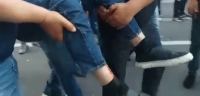 NEWS.am's cameraman’s leg is broken, he will probably undergo surgery