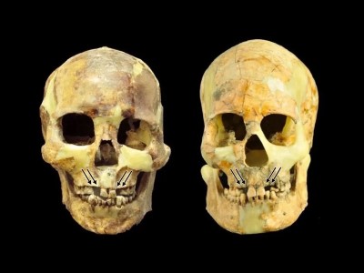 Археологи узнали о ритуальном удалении зубов на Тайване 4800 лет назад