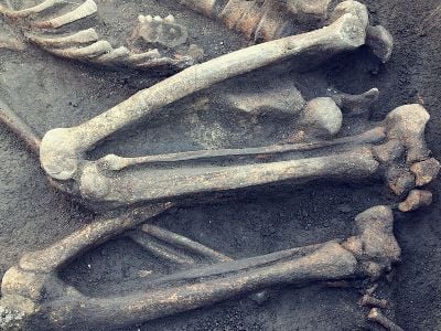 US woman arrested on charges of buying, selling human bones