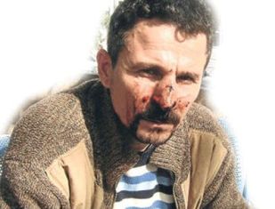 В турецкой полиции: «Алло, это полиция? Сейчас меня будут бить…»