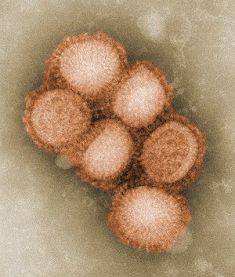 A/H1N1-ին փոխարինելու է գալիս «սարսափազդու» A/H3N2-ը