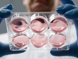 «Հրապարակ». Սիբիրախտի կարանտինը վերացնելու են