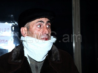 Աղջիկը վախից ճչում էր, նրա հորը ոստիկանները բռնի ուժով նստեցնում էին մեքենա. բեր