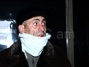 Բերանը կարած էջմիածնեցին վերադարձել է նախագահական. ընտանիքի հետ կգիշերի դրսում