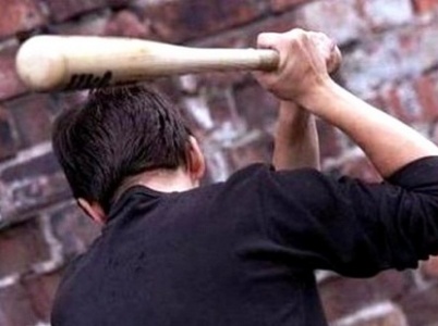 Զինված հարձակում Էջմիածնում. տանտիրոջը ծեծել են, ստիպել են ասել գումարի տեղը