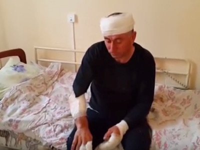 Пострадавший в ДТП армянин: Я не мог вылезти из автобуса