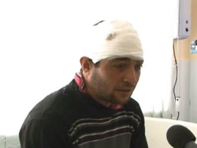 Որ արկակոծումն սկսվեց, կռացա փախա. Ադրբեջանի զինուժի արկակոծումից վիրավորված  բնակիչ