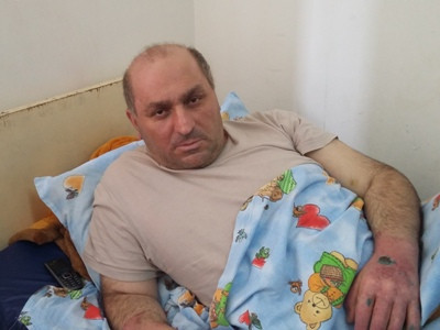 При атаке беспилотника в Нагорном Карабахе Геворг получил тяжелые ожоги