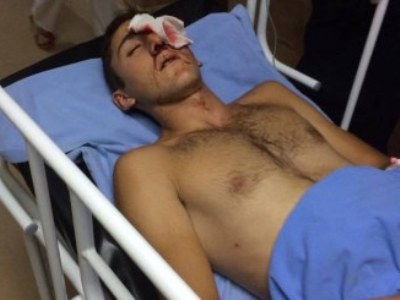 Лишившемуся глаза во время инцидента в ереванском квартале Сари тах Саяту Арутюняну сделали протезирование