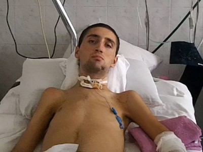 Раненный в апреле Аветис отправится в Москву на лечение