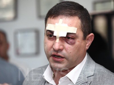 «Պնդուկիզմի հաղթանակ». ՓՊ ղեկավար անձանց կողմից ծեծված Արմեն Սողոմոնյանը որպես մեղադրյալ հրավիրվել է հարցաքննության