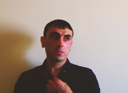 «Պոնչիկանոցի մոտ տեսա՝ մի տղա նստած է աչքերը փակ». Ոստիկանները կողոպուտ կատարած անձին բռնեցին դեպքից րոպեներ անց