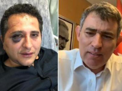 Էրդողանի թիկնապահները դաժան ծեծի են ենթարկել փողոցը փակելու դեմ բողոքած իրավաբանին