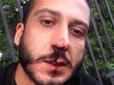 В Тбилиси все еще неспокойно: Оппозиция созывает новую акцию